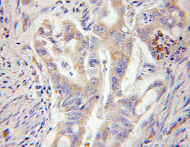 RPL13 Antibody in Immunohistochemistry (Paraffin) (IHC (P))