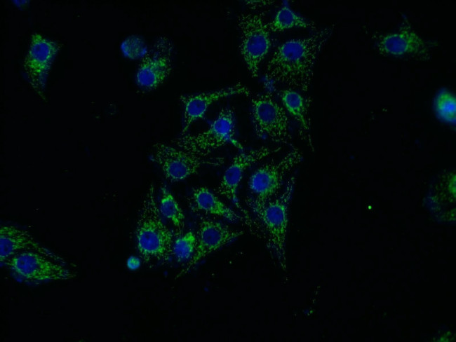 ASAH1 Antibody in Immunocytochemistry (ICC/IF)