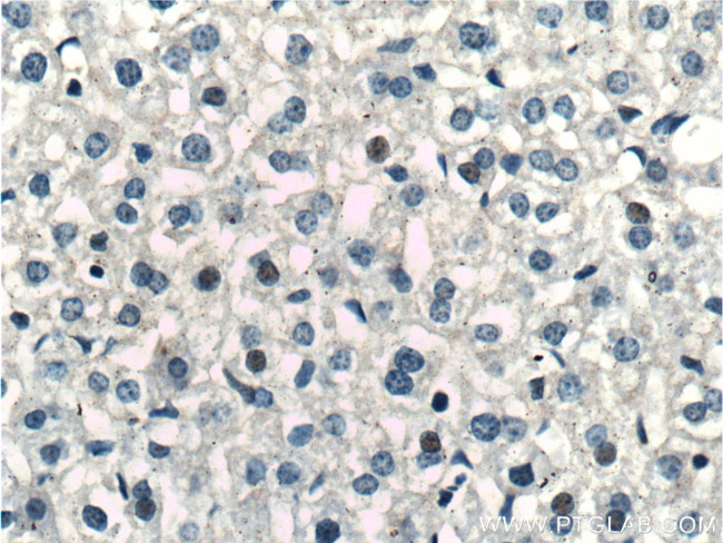 PPP2R5C Antibody in Immunohistochemistry (Paraffin) (IHC (P))