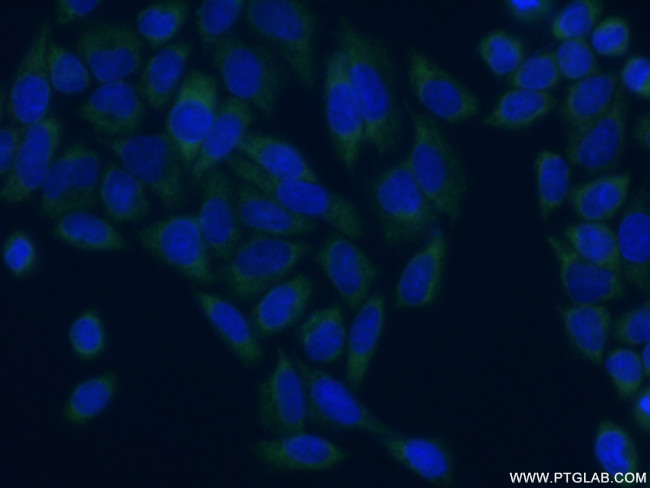 EIF4G3 Antibody in Immunocytochemistry (ICC/IF)