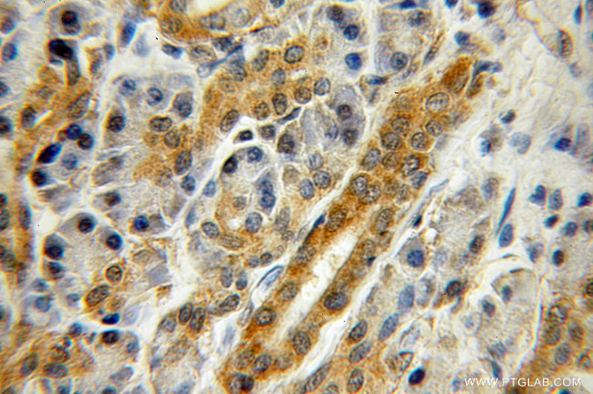 ZNF2 Antibody in Immunohistochemistry (Paraffin) (IHC (P))