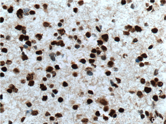 TLE1 Antibody in Immunohistochemistry (Paraffin) (IHC (P))