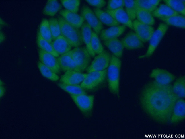 RPLP0 Antibody in Immunocytochemistry (ICC/IF)