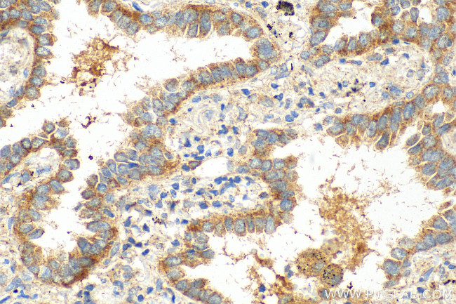 SPIRE1 Antibody in Immunohistochemistry (Paraffin) (IHC (P))