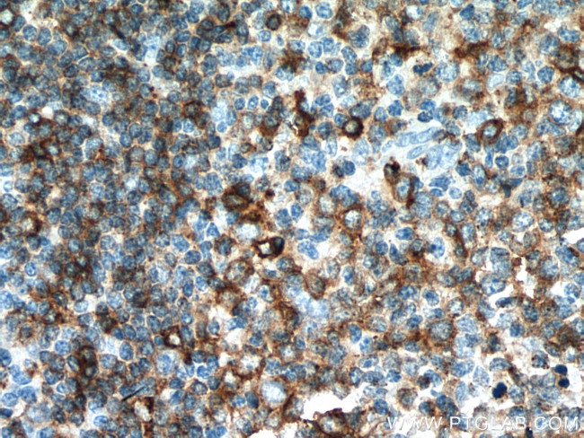 HLA-DPB1 Antibody in Immunohistochemistry (Paraffin) (IHC (P))