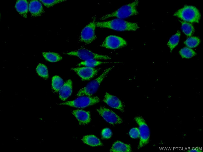LPXN Antibody in Immunocytochemistry (ICC/IF)