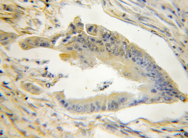 STMN3 Antibody in Immunohistochemistry (Paraffin) (IHC (P))