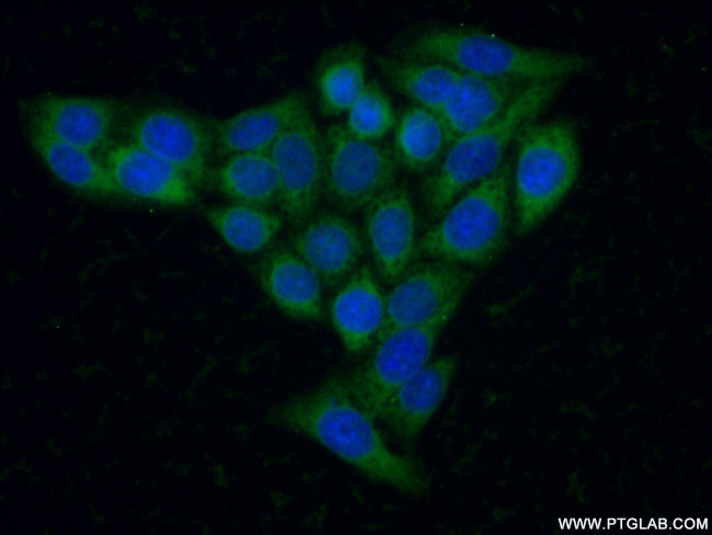 HEXA Antibody in Immunocytochemistry (ICC/IF)