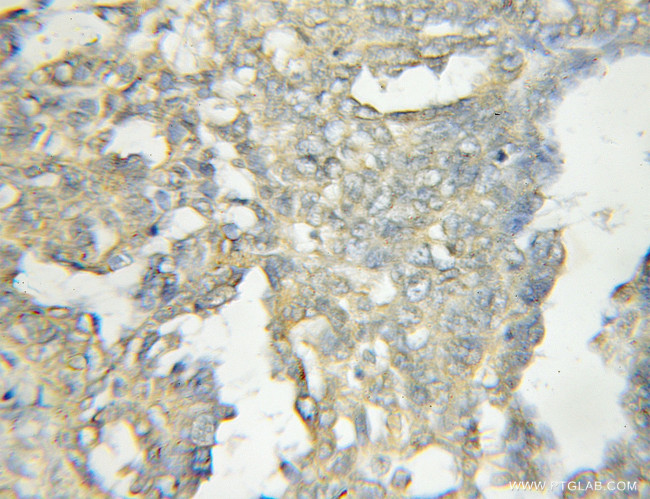 OSBPL11 Antibody in Immunohistochemistry (Paraffin) (IHC (P))