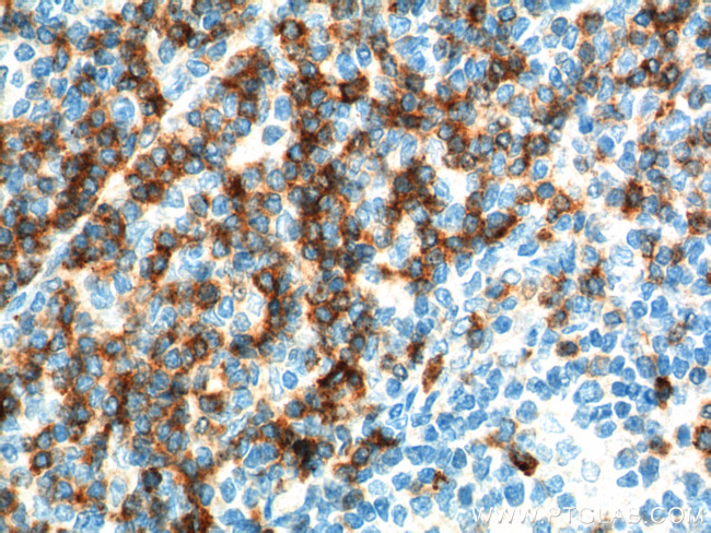 CD7 Antibody in Immunohistochemistry (Paraffin) (IHC (P))