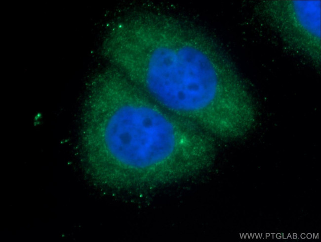 RAB35 Antibody in Immunocytochemistry (ICC/IF)