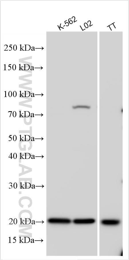 TIFA Antibody in Western Blot (WB)