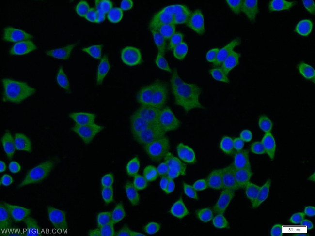 PTP1B Antibody in Immunocytochemistry (ICC/IF)