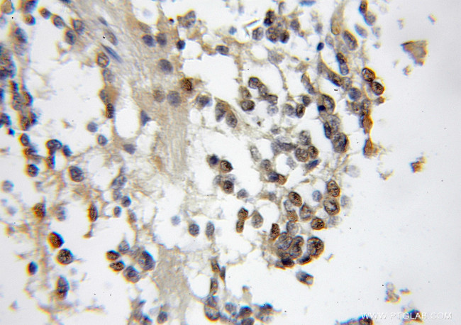 CBFA2T2 Antibody in Immunohistochemistry (Paraffin) (IHC (P))