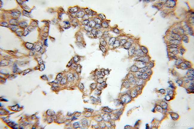 ENT1 Antibody in Immunohistochemistry (Paraffin) (IHC (P))