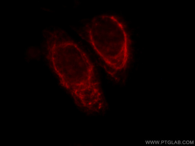 KRT81 Antibody in Immunocytochemistry (ICC/IF)