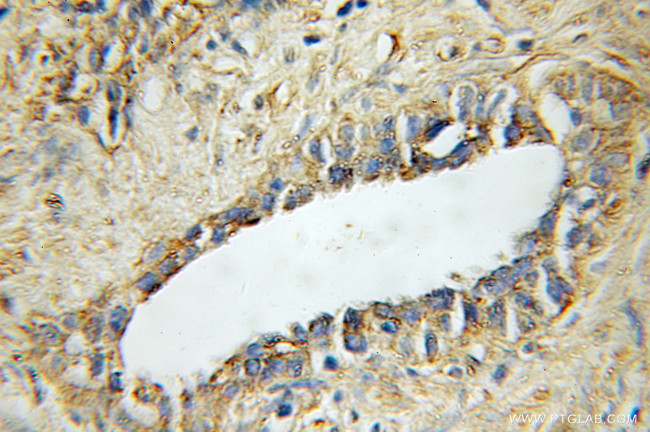 STAMBP Antibody in Immunohistochemistry (Paraffin) (IHC (P))