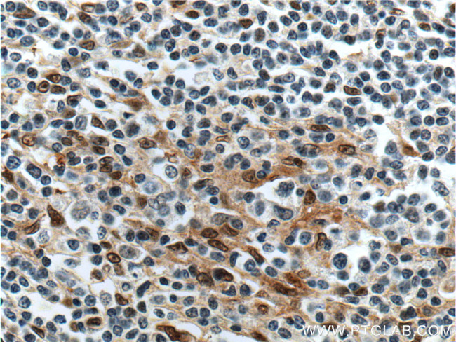FLI1 Antibody in Immunohistochemistry (Paraffin) (IHC (P))