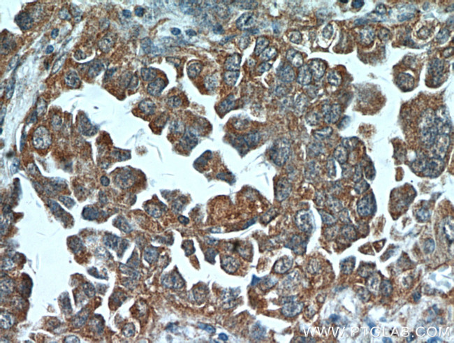 ART5 Antibody in Immunohistochemistry (Paraffin) (IHC (P))