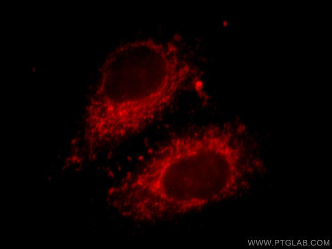 fibrosin Antibody in Immunocytochemistry (ICC/IF)