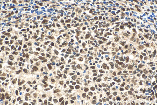 DDX1 Antibody in Immunohistochemistry (Paraffin) (IHC (P))
