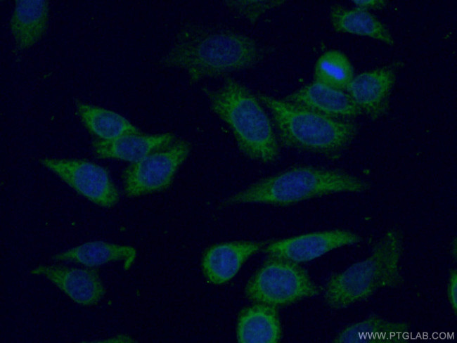 UMP/CMP kinase Antibody in Immunocytochemistry (ICC/IF)