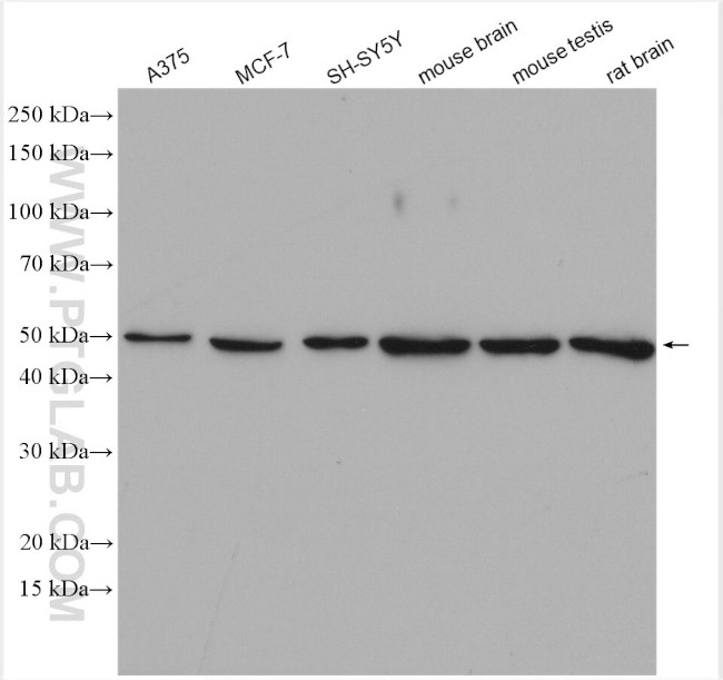 Dynamitin (1-401 AA) Antibody in Western Blot (WB)