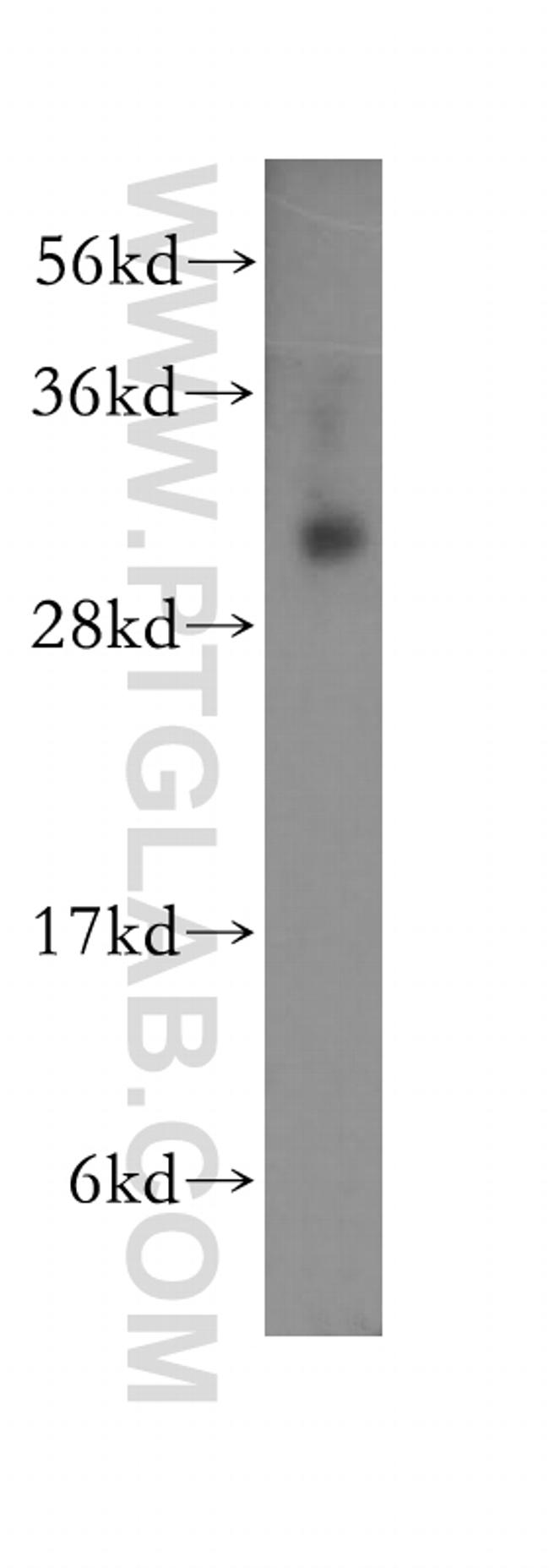 RYBP Antibody in Western Blot (WB)