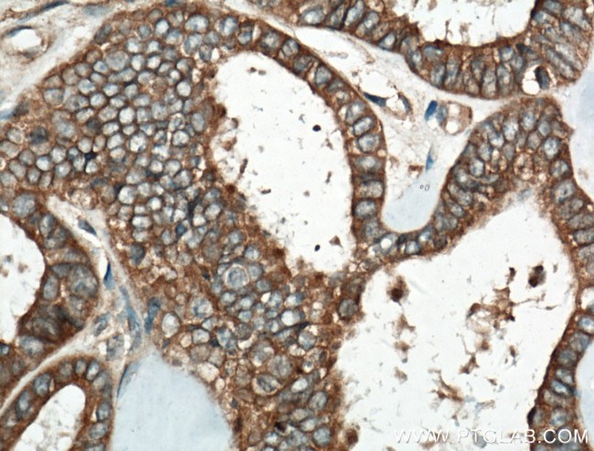HPS6 Antibody in Immunohistochemistry (Paraffin) (IHC (P))