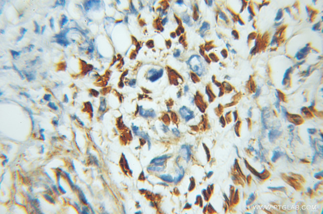 ZNF266 Antibody in Immunohistochemistry (Paraffin) (IHC (P))