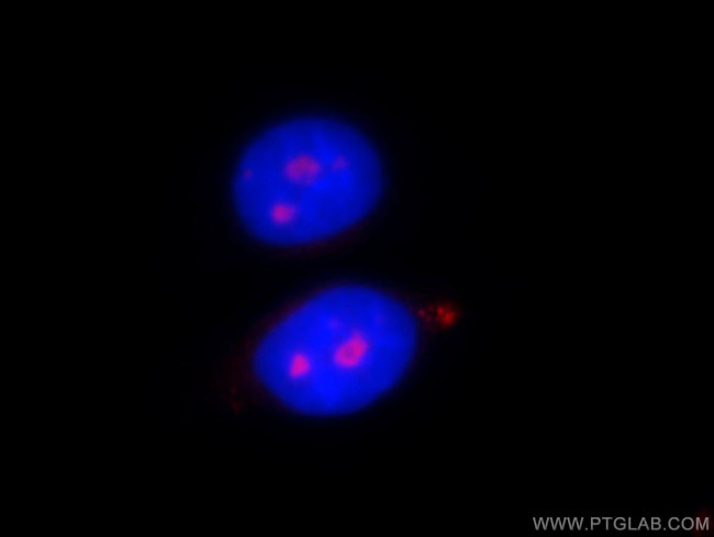 PWP2 Antibody in Immunocytochemistry (ICC/IF)