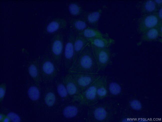 POF1B Antibody in Immunocytochemistry (ICC/IF)