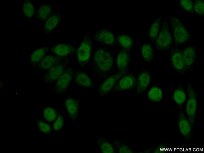 ASRGL1 Antibody in Immunocytochemistry (ICC/IF)