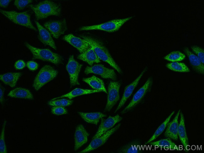 EEF1A1 Antibody in Immunocytochemistry (ICC/IF)