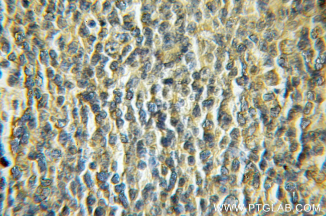 NDOR1/NR1 Antibody in Immunohistochemistry (Paraffin) (IHC (P))