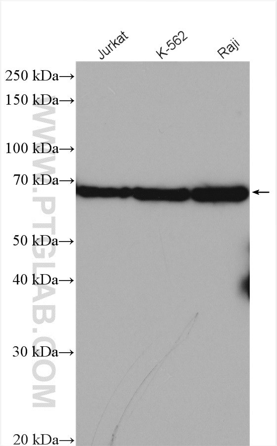 IL2RG Antibody in Western Blot (WB)