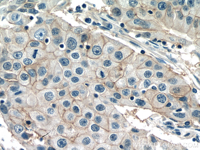 NAT2 Antibody in Immunohistochemistry (Paraffin) (IHC (P))