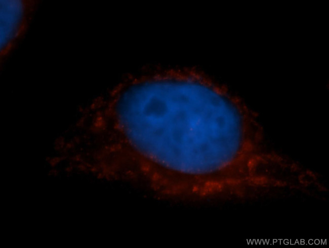COX7C Antibody in Immunocytochemistry (ICC/IF)