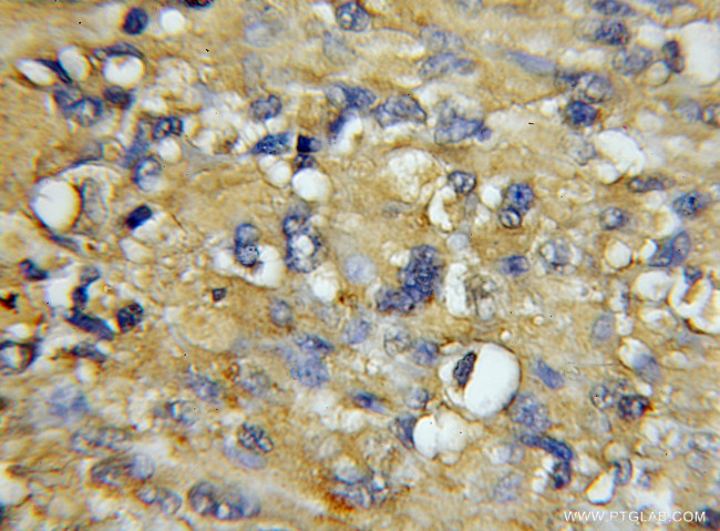 COX7A1 Antibody in Immunohistochemistry (Paraffin) (IHC (P))