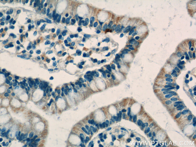 C1QTNF3 Antibody in Immunohistochemistry (Paraffin) (IHC (P))