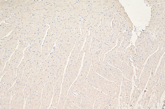 COX7B Antibody in Immunohistochemistry (Paraffin) (IHC (P))