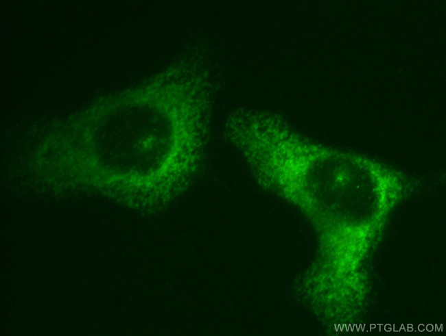 EIF3M Antibody in Immunocytochemistry (ICC/IF)