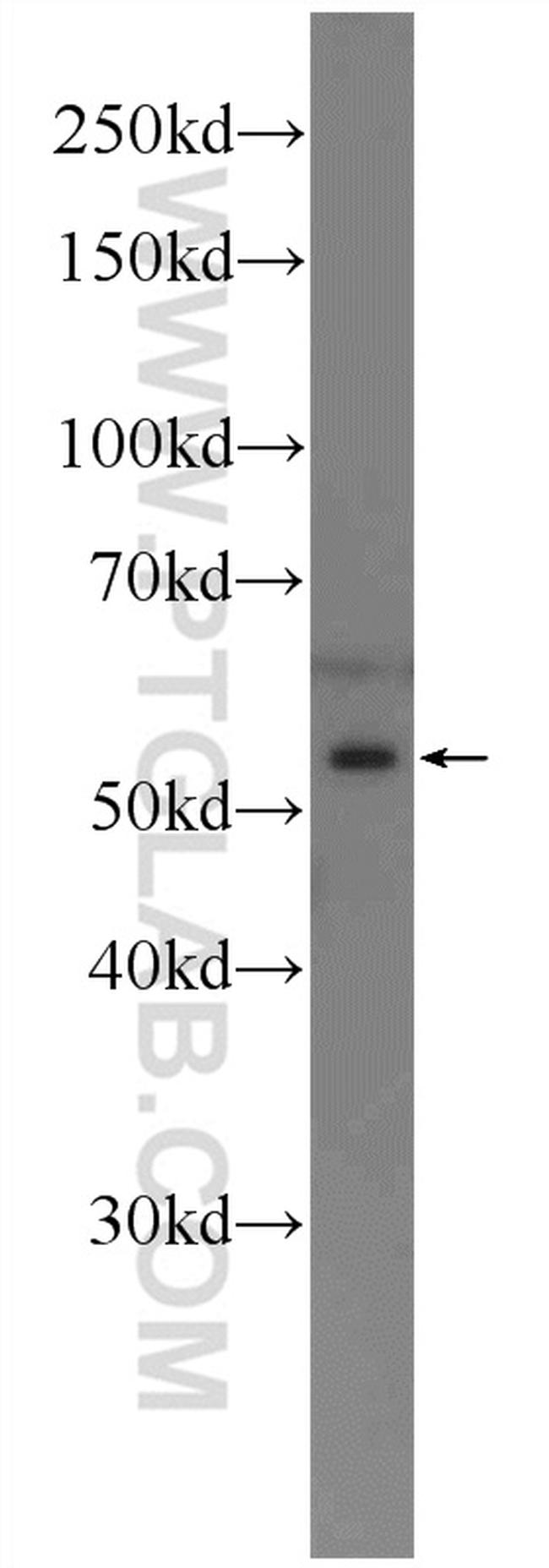 RARG Antibody in Western Blot (WB)