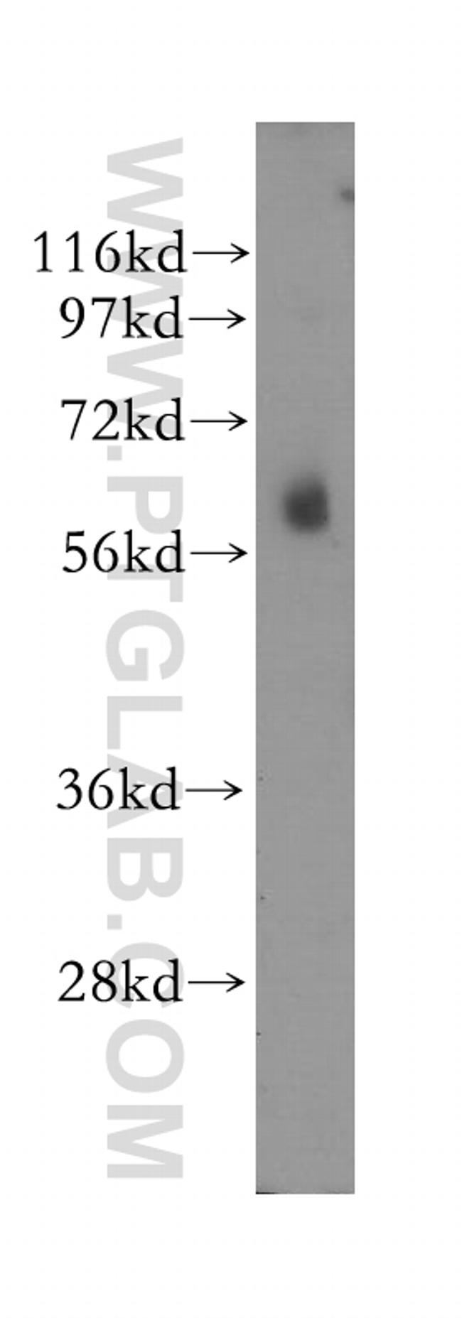 STK32C Antibody in Western Blot (WB)
