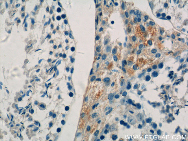 COX6B2 Antibody in Immunohistochemistry (Paraffin) (IHC (P))