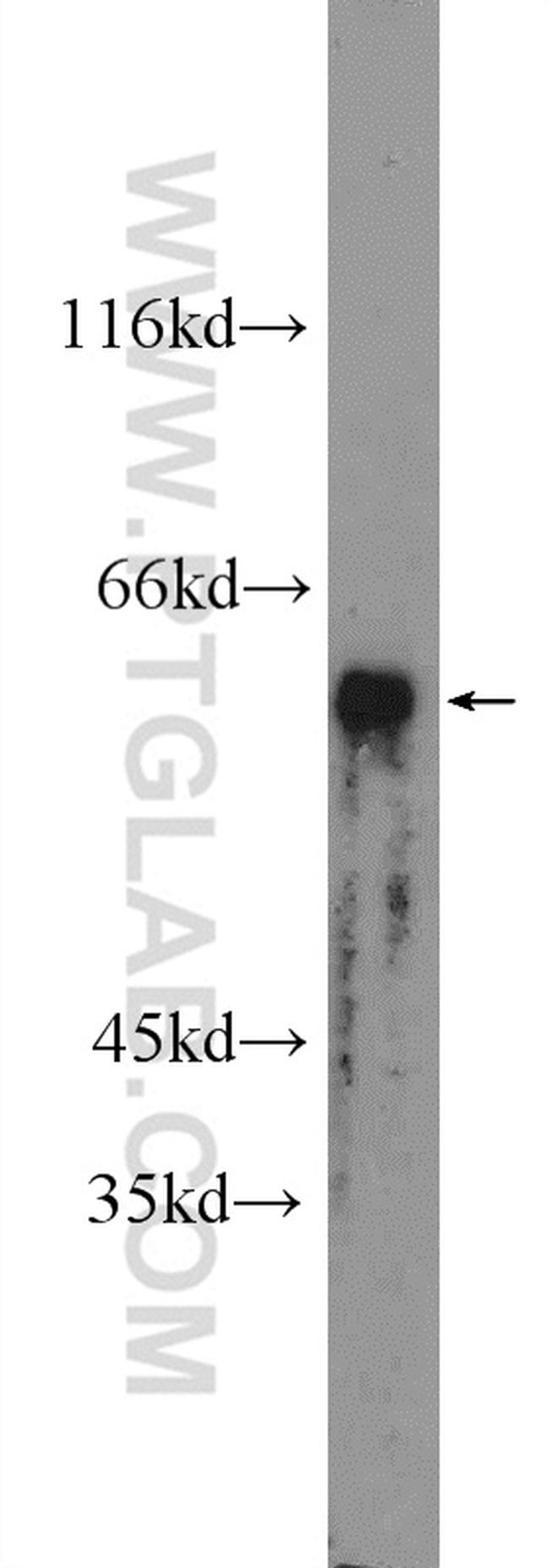PRAME Antibody in Western Blot (WB)