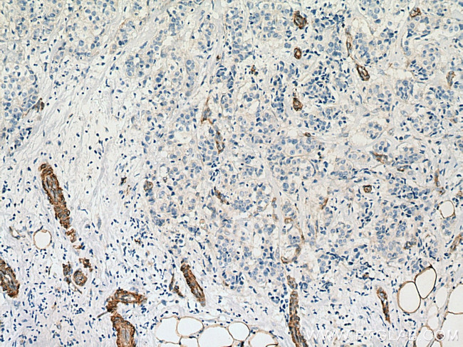 EHD2 Antibody in Immunohistochemistry (Paraffin) (IHC (P))