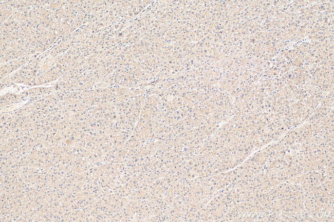 PNPLA3 Antibody in Immunohistochemistry (Paraffin) (IHC (P))