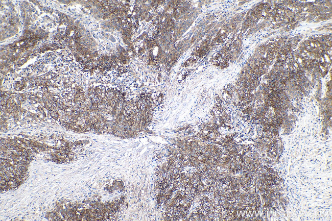 CA9 Antibody in Immunohistochemistry (Paraffin) (IHC (P))