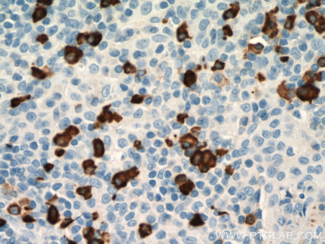 Human IgA Heavy Chain Antibody in Immunohistochemistry (Paraffin) (IHC (P))
